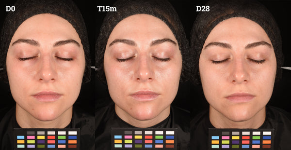 Clinical Study Image